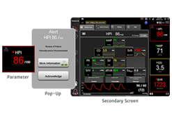 Acumen Software de índice de previsão de hipotensão