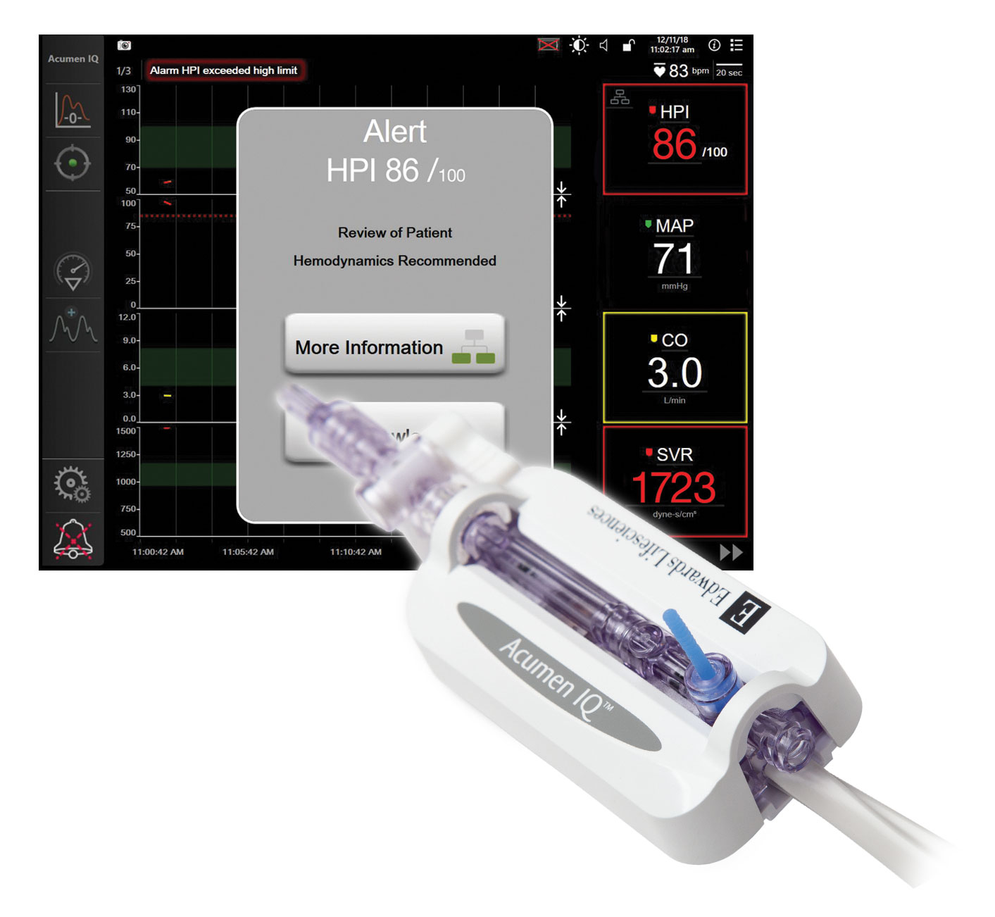 Acumen Hypotension Prediction Index software and Acumen IQ sensor