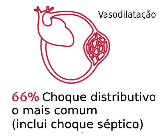 Os tipos de choque s&atilde;o importantes 1