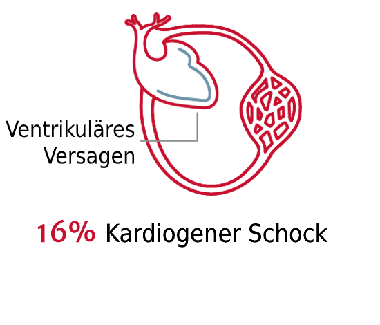 Schockarten sind von Bedeutung 3