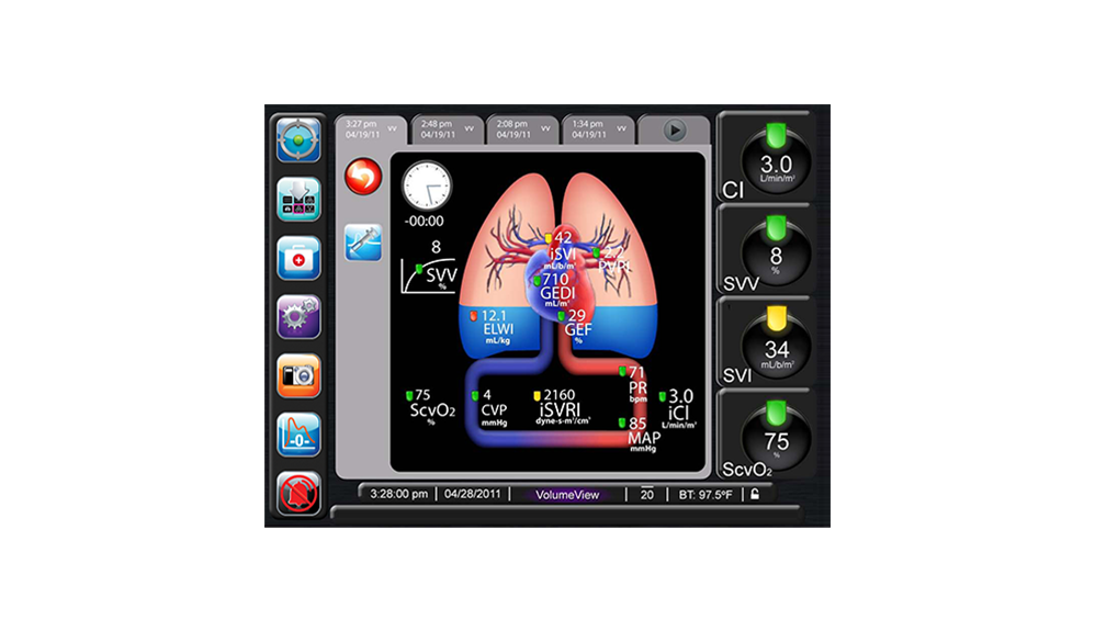 Parámetros de salida de VolumeView