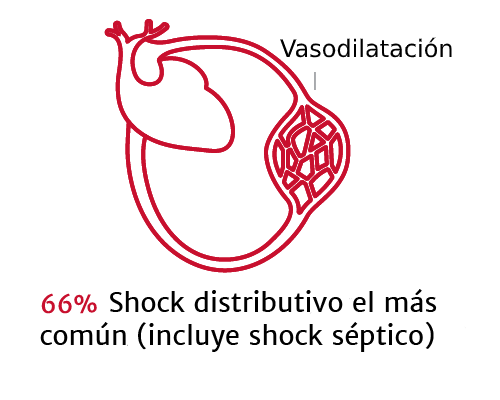 La importancia de los tipos de shock 1