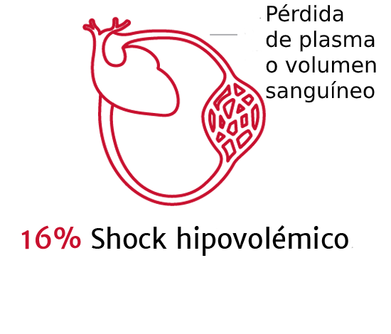 La importancia de los tipos de shock 2