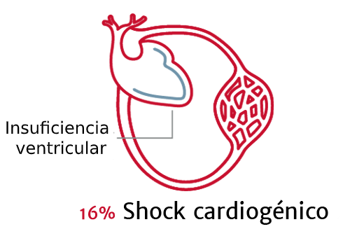 La importancia de los tipos de shock 3