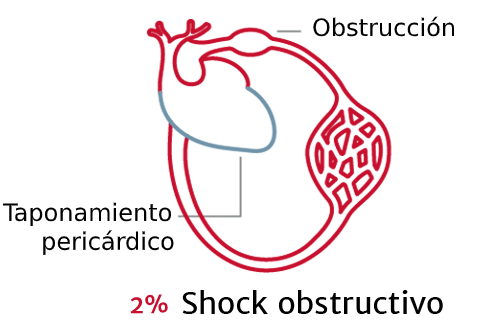 La importancia de los tipos de shock 4