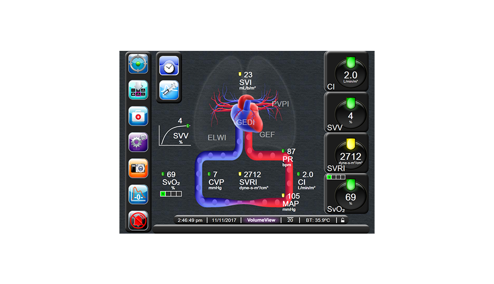 Parametri di uscita del set VolumeView