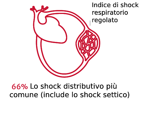 L'importanza del tipo di shock 1