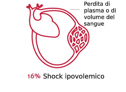 L'importanza del tipo di shock 2