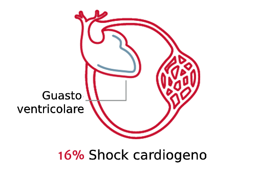 L'importanza del tipo di shock 3
