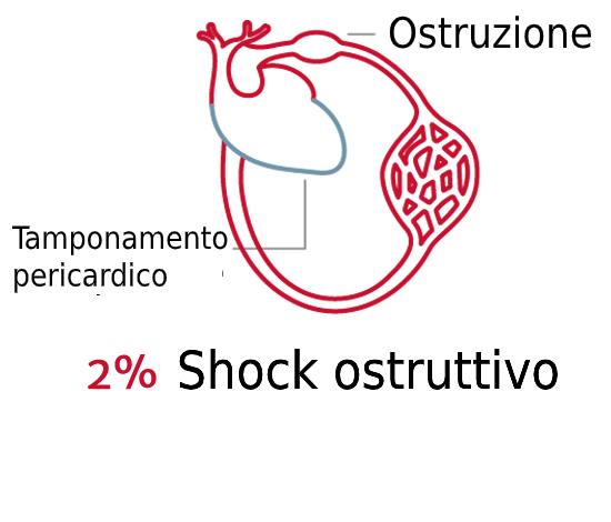 L'importanza del tipo di shock 4